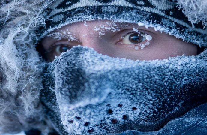 How to Treat Hypothermia